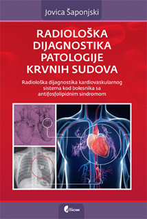 upload202112172028441049.png Radiološka dijagnostika kardiovaskularnog sistema kod bolesnika sa antifosfolipidnim sindromom - Slika 1