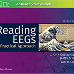 Reading Eegs A Practical Approach 2E