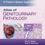 Atlas of Genitourinary Pathology A Pattern Based Approach