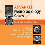 Advanced Neuroradiology Cases