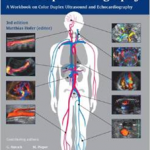 Teaching Manual of Color Duplex Sonography