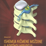 Ishemija kičmene moždine u aortnoj hirurgiji