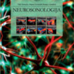 NEUROSONOLOGIJA