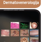 Dermatovenerologija
