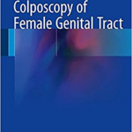 Colposcopy of Female Genital Tract