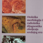 Otološka morfologija i radiološka dijagnostika oboljenja srednjeg uva
