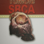 Tumori srca