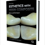 Esthetics with Resin Composites: Basics and Techniques