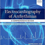 Electrocardiography of Arrhythmias: a Comprehensive Review
