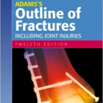 Adams's Outline of Fractures , 12th edition