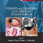 Diseases and Disorders of the Orbit and Ocular Adnexa