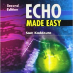 Echo Made Easy  2ed IE