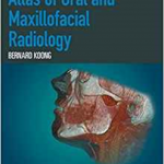 Atlas of Oral and Maxillofacial Radiology