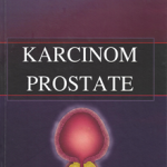 Karcinom prostate
