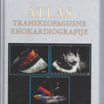 Atlas transezofagusne ehokardiografije  K