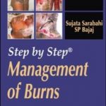 Step by Step Management of Burns