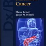Dx/Rx: Pancreatic Cancer