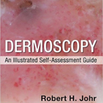Dermoscopy: An Illustrated Self-Assessment Guide