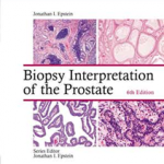 BIOPSY INTERPRETATION OF PROSTATE 6E  CB