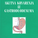 Z36382 Akutna krvarenja iz gastroduodenuma