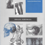 Oralna hirurgija