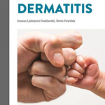 Atopijski dermatitis