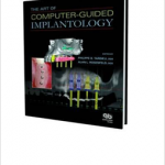 The Art of Computer-guided Implantology