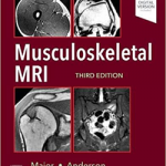 Musculoskeletal Mri