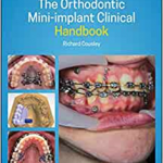 Orthodontic Mini implant Handboo