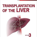 Transplantation of the Liver,