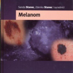 Melanom