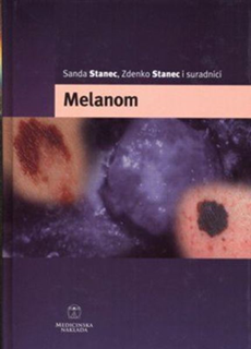 upload202202131100272957.png Melanom - Slika 1