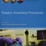 Pediatric Anesthesia Procedures