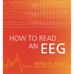 How to Read an EEG