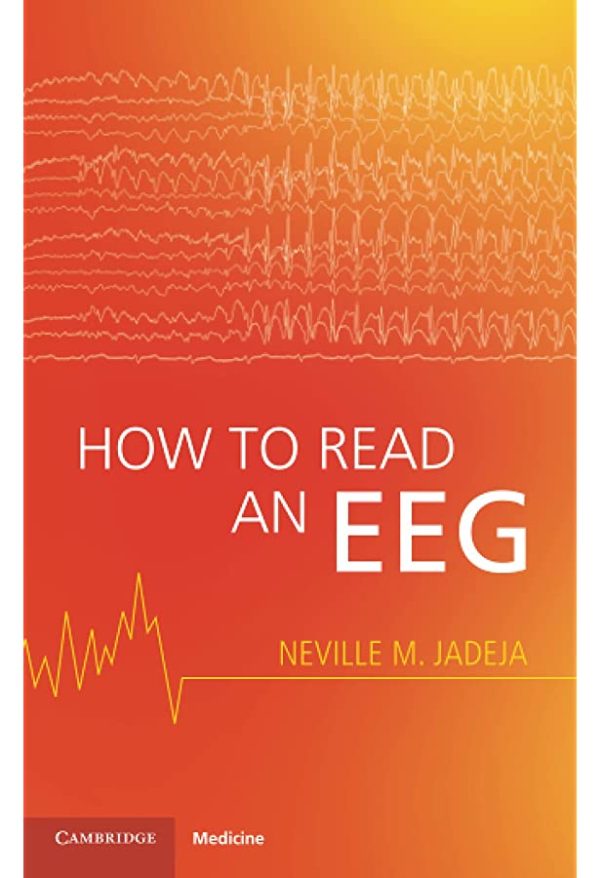 How to Read an EEG - Image 1