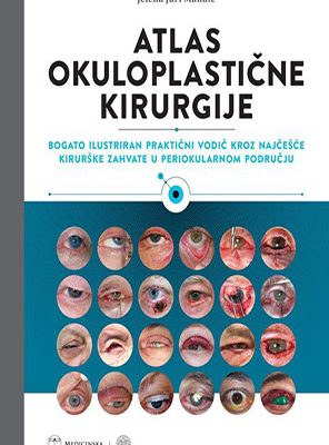 Atlas Okuloplastične Kirurgije