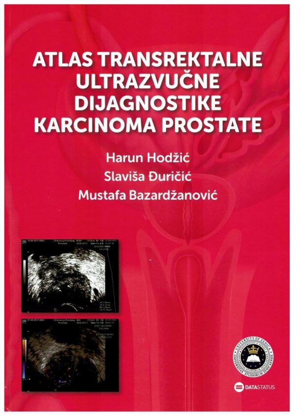 Atlas transrektalne ultrazvučne dijagnostike karcinoma prostate 1