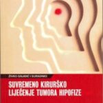 Suvremeno kirurško liječenje tumora hipofize