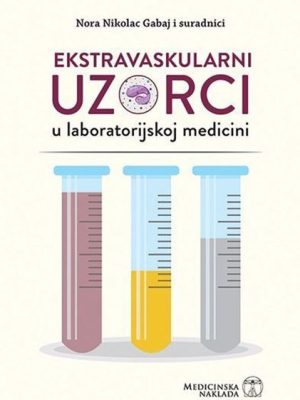Ekstravaskularni Uzorci U Laboratorijskoj Medicini