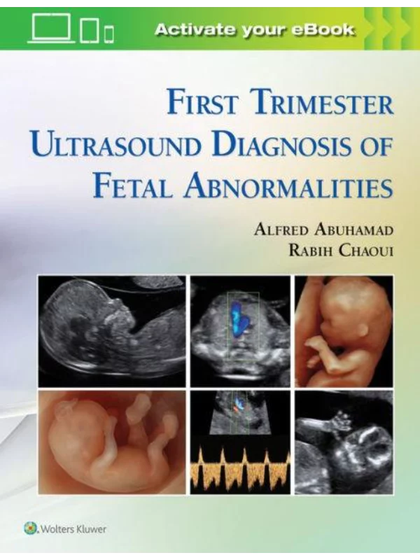 First Trimester Ultrasound Diagnosis of Fetal Abnormalities - Image 1