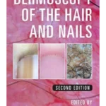 Dermoscopy of the Hair and Nails