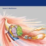 Nerve Surgery