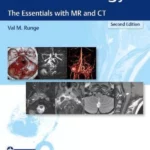 Neuroradiology