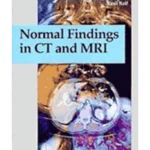 Normal Findings in CT and MRI