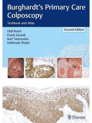 Burghardt's Primary Care Colposcopy