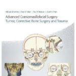 Advanced Craniomaxillofacial Surgery Tumor, Corrective Bone Surgery, and Trauma