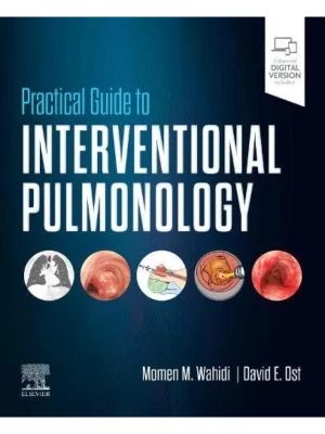 Practical Guide to Interventional Pulmonology