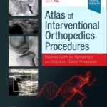 Atlas of Interventional Orthopedics ProceduresEssential Guide for Fluoroscopy and Ultrasound Guided Procedures