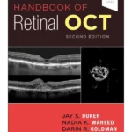 Handbook of Retinal OCT: Optical Coherence Tomography, 2nd Edition
