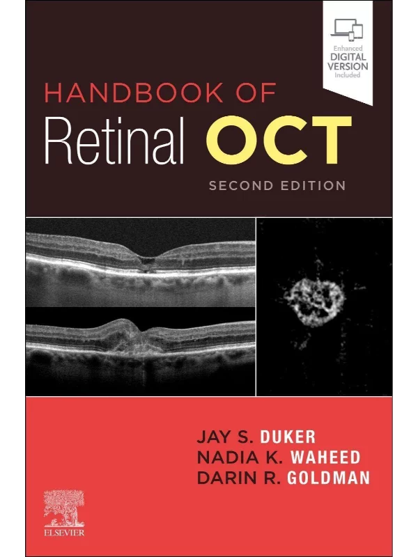 Handbook of Retinal OCT: Optical Coherence Tomography, 2nd Edition - Image 1